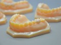 Stratasys 3D 打印機優(yōu)化義齒制作