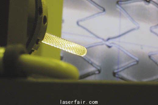 一個(gè)激光切割且張開(kāi)的血管支架