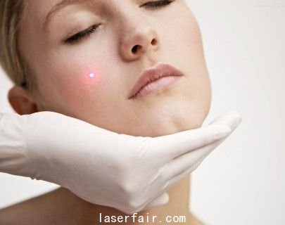 如何評(píng)估激光嫩膚的安全性？