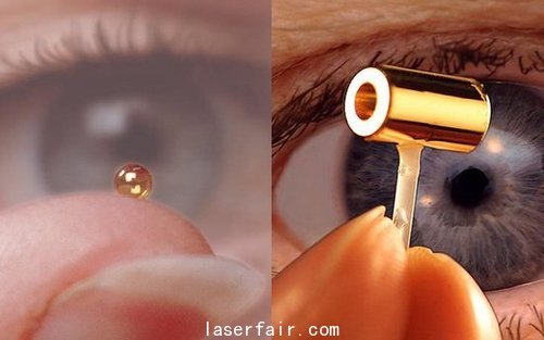 最強激光產(chǎn)生&ldquo;創(chuàng)世&rdquo;爆炸 模擬人造太陽