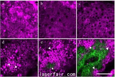利用專門顯微鏡觀察皮膚表層，衡量皮膚細(xì)胞中與歲月有關(guān)的自然變化程度